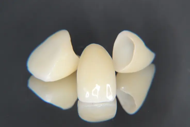 オールセラミッククラウンの模型
