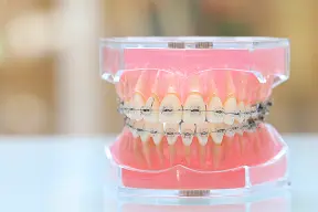 きれいな骨格と歯の模型