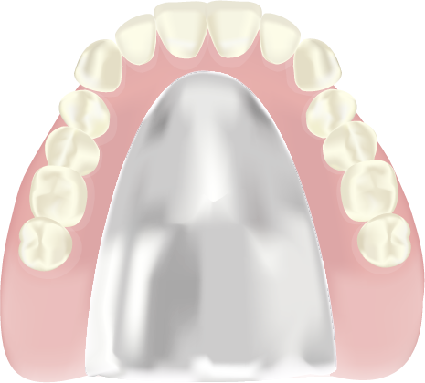 コバルトクロム床の入れ歯